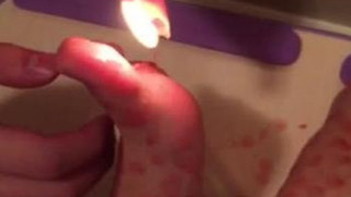 今天玩了滴蜡(/ω\) 蜡烛是低温蜡烛 50多度 但还是好疼啊(>﹏<)庆祝100粉丝特意发个视频庆祝一下~~ 今天玩了滴蜡(/ω\) 蜡烛是低温蜡烛 50多度 但还是好疼啊(>﹏<)庆祝100粉丝特意发个视频庆祝一下~~
