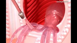 1 1